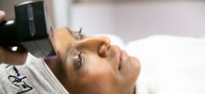 Collagen banking includes Morpheus8, Skinpen Microneedling, RF radiofrequency laser technology